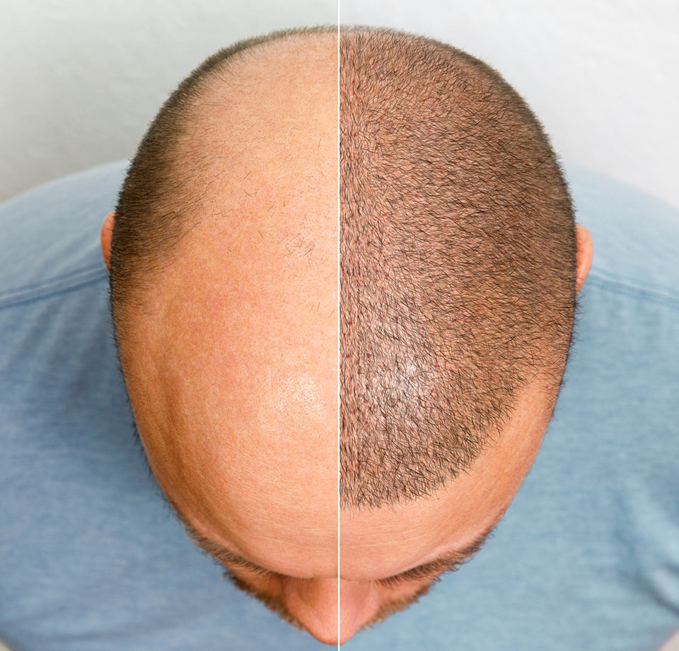 Dantų gydymas ir protezavimas Turkijoje